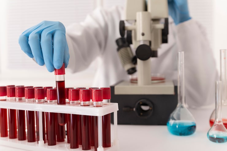coronavirus blood samples arrangement lab 23 2149107259